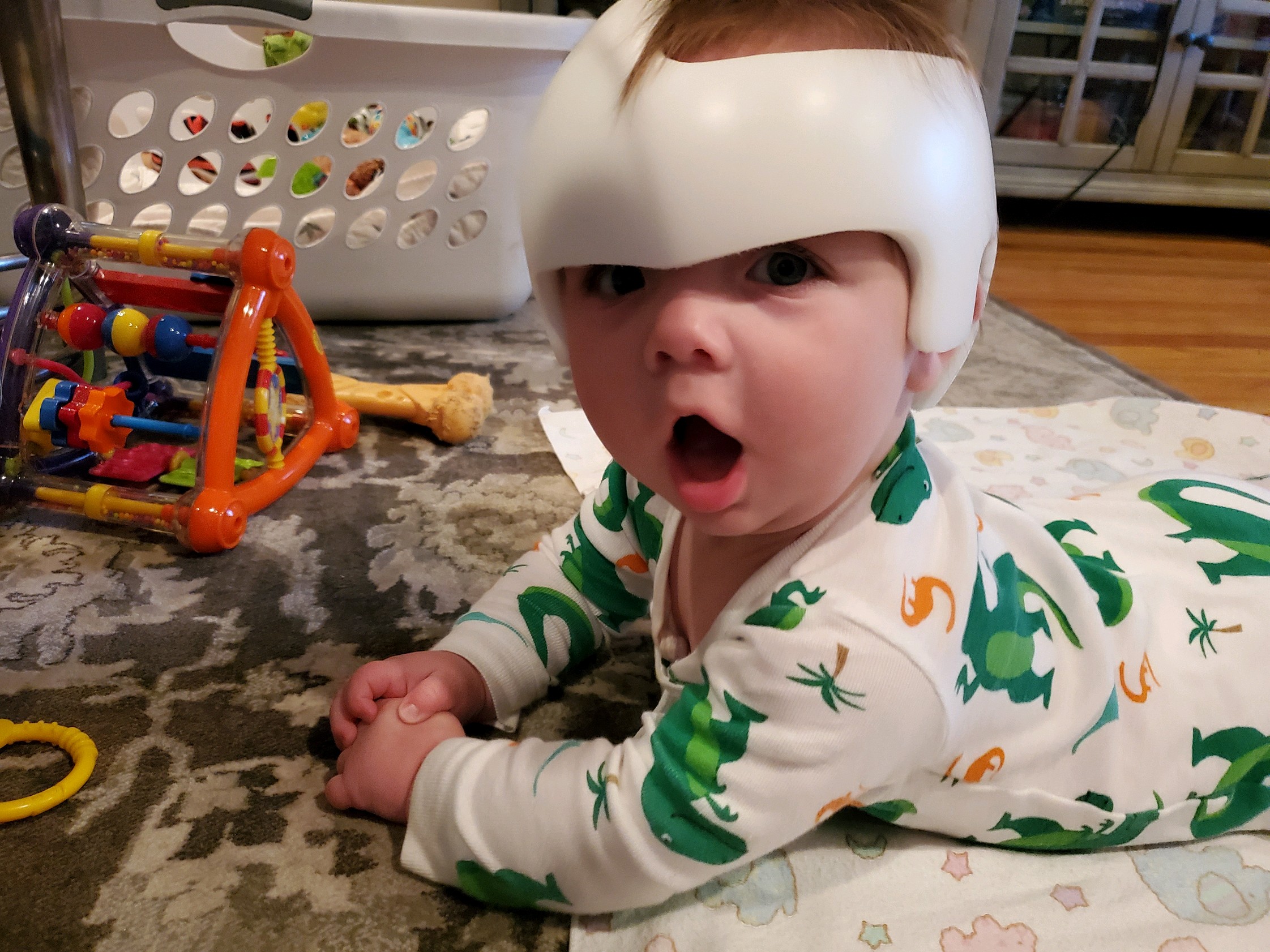 Torticollis: What to Watch Out For